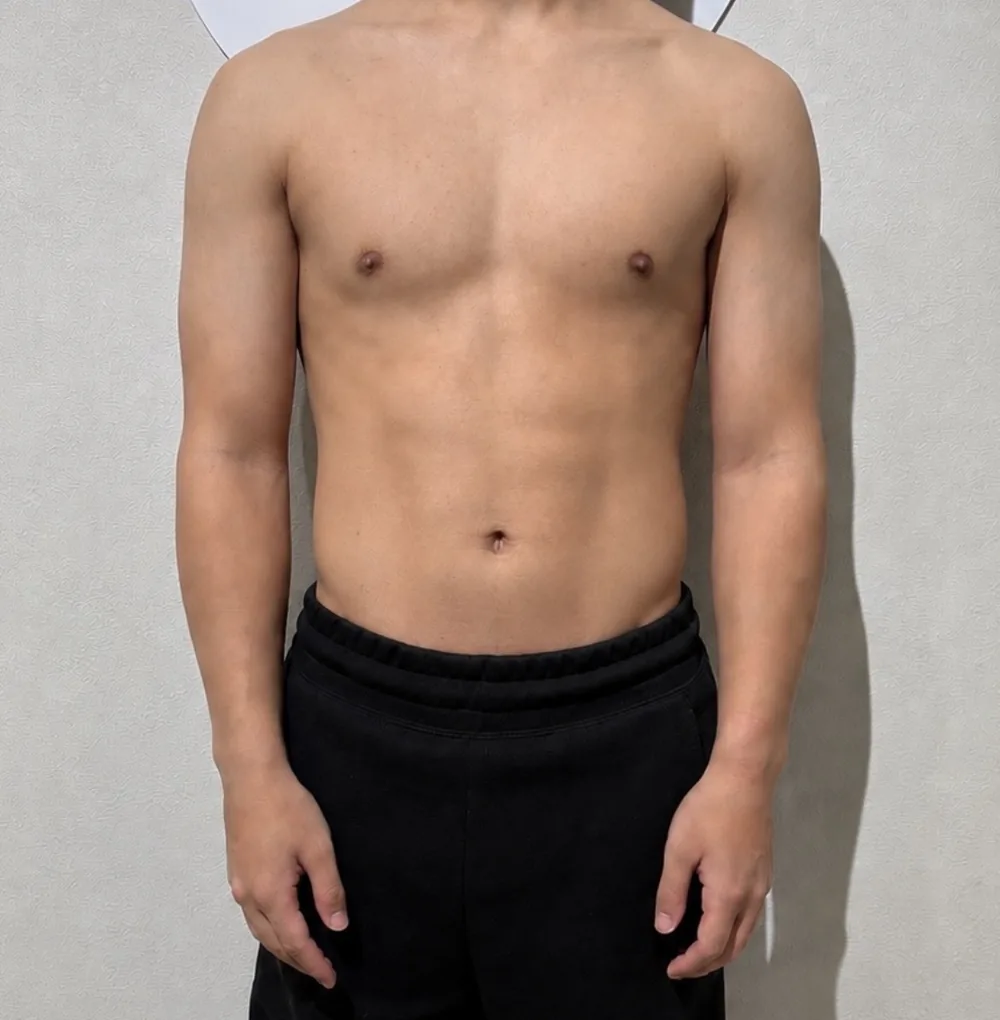 男性Takeruさんの約半年後アフター写真(−6.0kg)