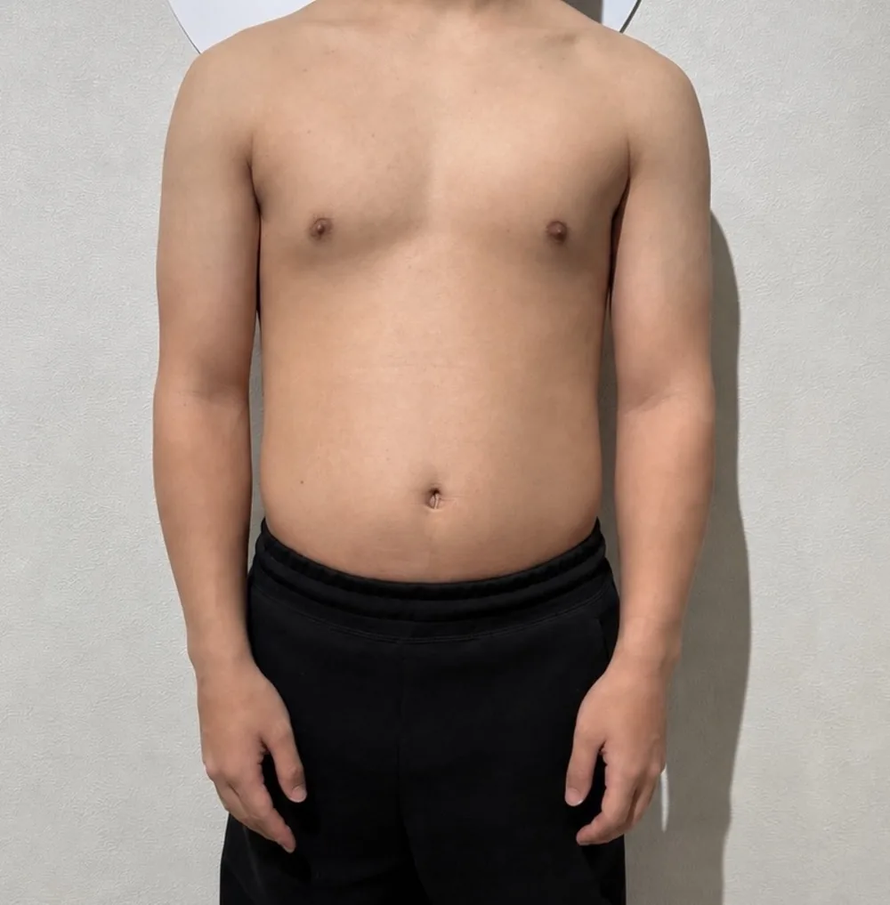 男性Takeruさんのビフォー写真