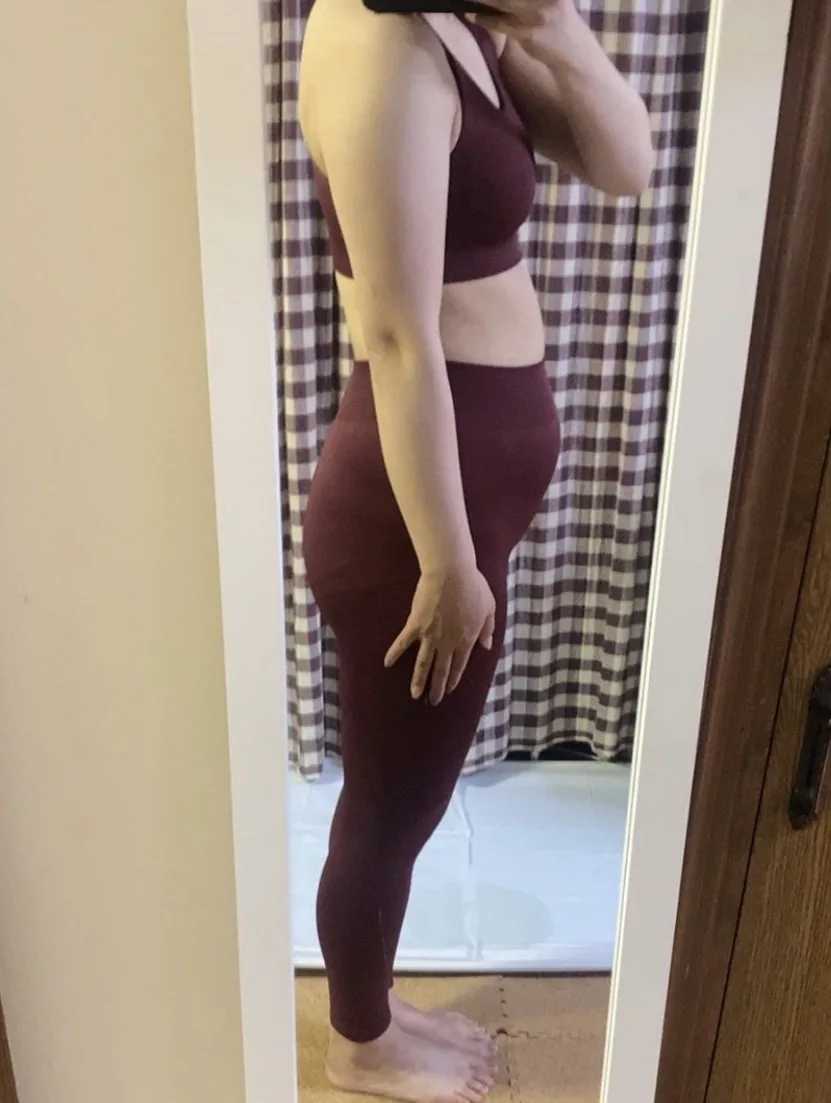 女性・お腹まわりのビフォー写真